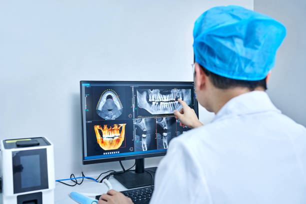Best Emergency Cosmetic Dentistry (e.g., broken veneers) in South San Jose Hills, CA
