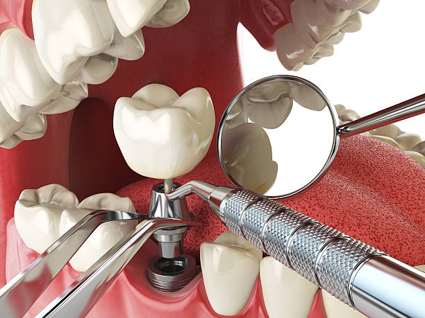 Trusted CA Emergency Dental Service Experts